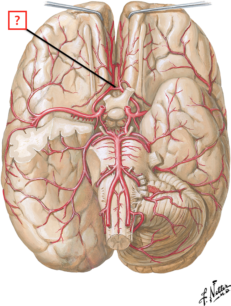 Arteries Of Brain Inferior View Flashcards Memorang