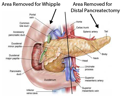 Tumors Nclex Rn Fluid Electrolyte Imbalances Body Systems