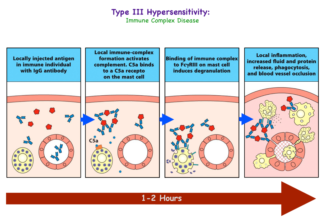 Hypersensitivity Reactions Immunology Flashcards Memorang