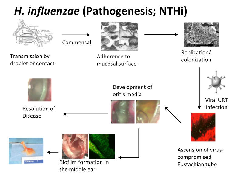 Image result for pathogenesis of haemophilus influenzae