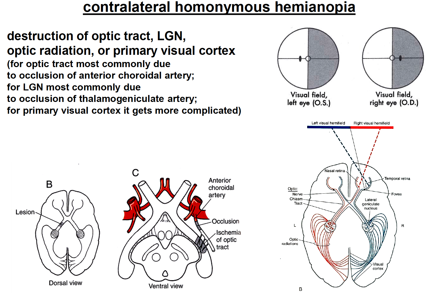 Contralateral Homonymous Lower Quadrantanopia - ovulation symptoms
