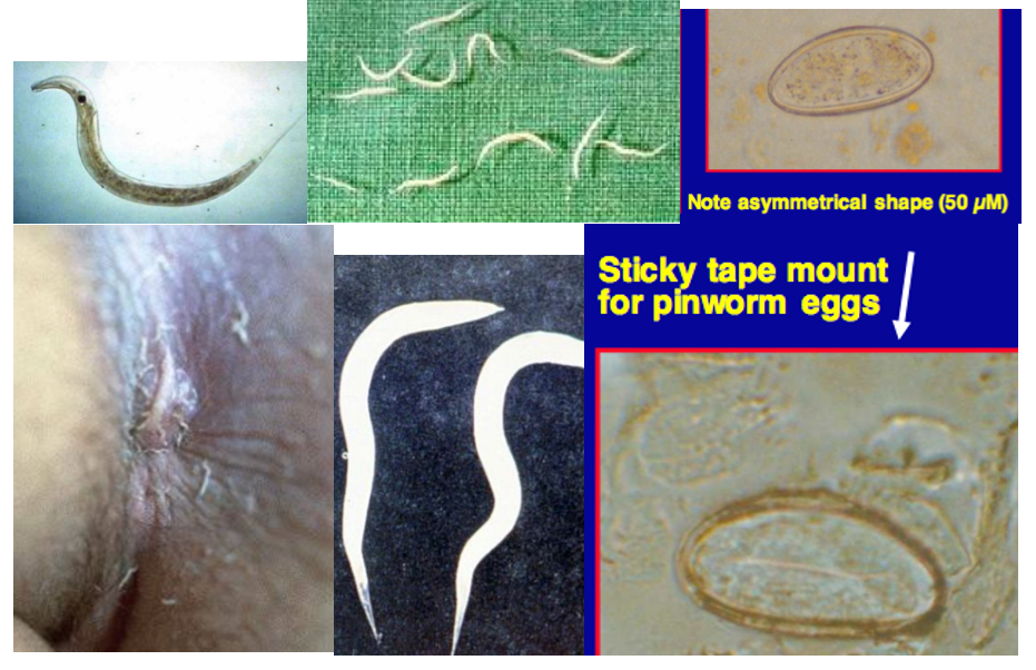 pinworm ascaris