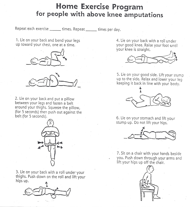 Above Knee Amputation Exercises For Strength And Range Of Motion ...