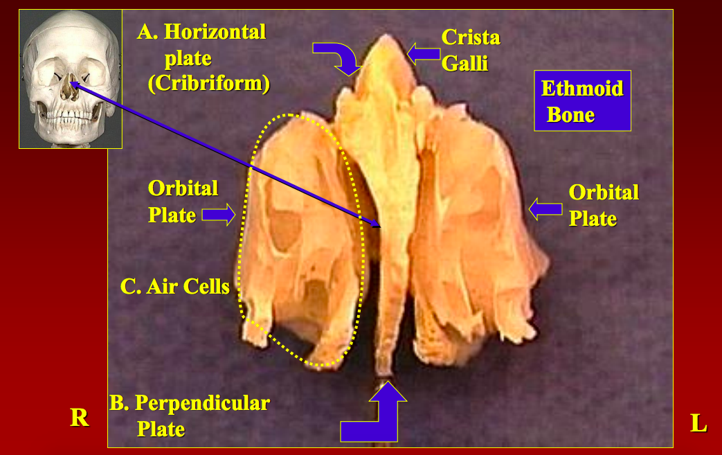 Perpendicular Plate Of Ethmoid Bone 3317