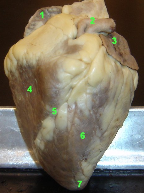 Get Coronary Sinus Sheep Heart Pics