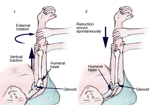 Orthopedic Surgery Usmle Step 2 Ck Surgery Flashcards Memorang