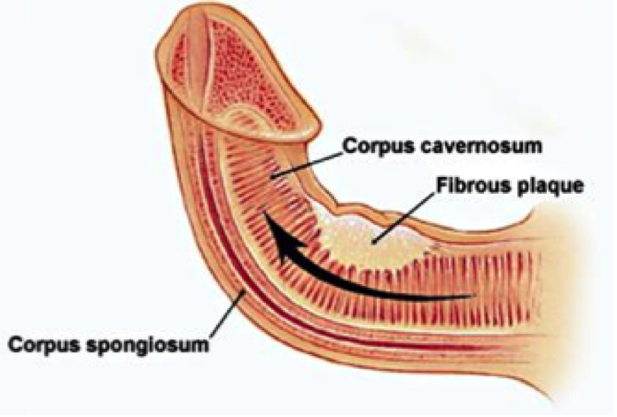 corpus cavernosum