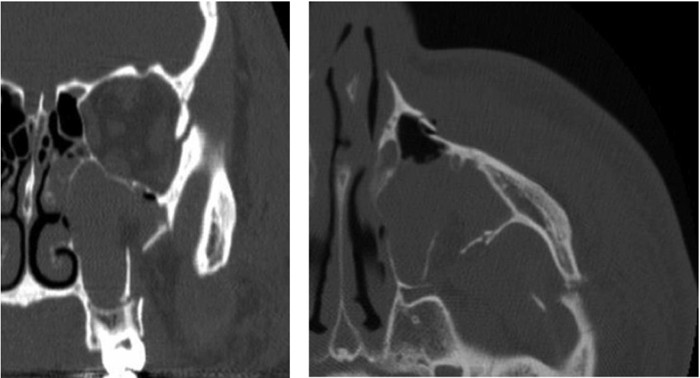 A 24 Year Old Male Patient Presents To The Emergency Department