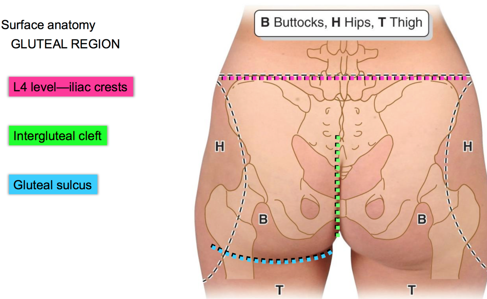 Extents of gluteal region
iliac crest, intergluteal cleft, gluteal sulcus