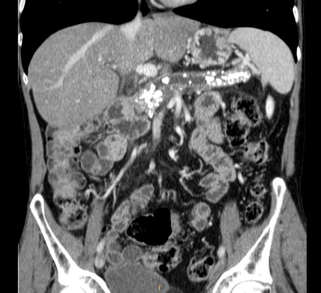 Ct Scan Results Next Day - ct scan machine