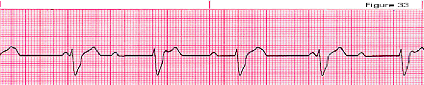 Clinical Acls 3 Cardio 3 Flashcards Memorang