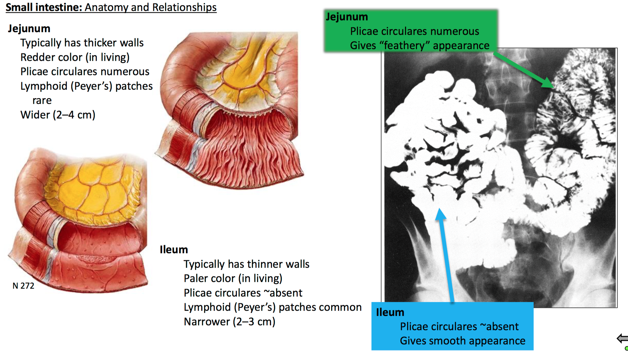 Ileum Anatomy - Anatomy Reading Source