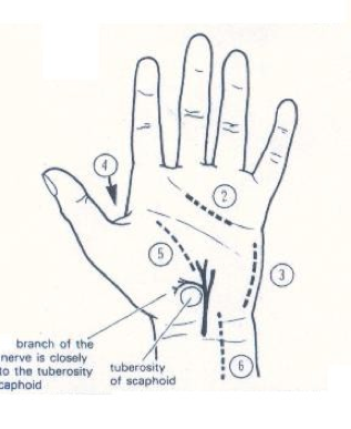 Hand Infection Incision