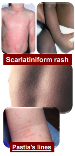 Schultzcharlton test