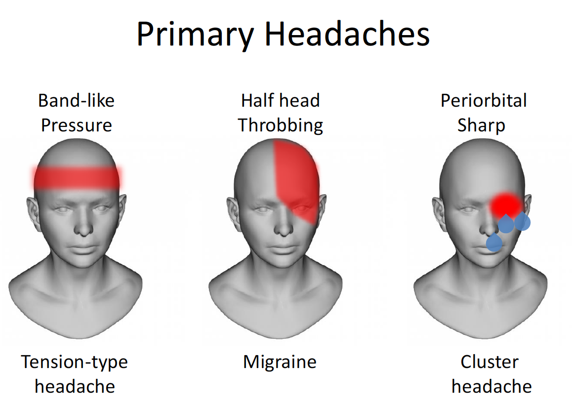Headache Pathophysiology 2/27 (BB) Flashcards | Memorang