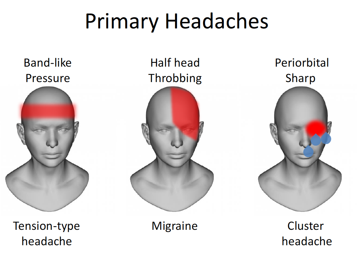 Картинки виды головной. Types of headache. Primary headaches: Migraine, tension-Type headache, Cluster headache. Headache Types Primary. Types of headache картинка.